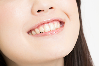 審美歯科・ホワイトニング