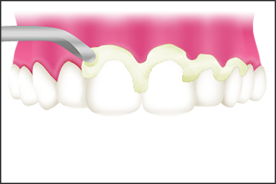 ②ペーストを塗布