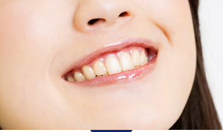 審美歯科・ホワイトニング